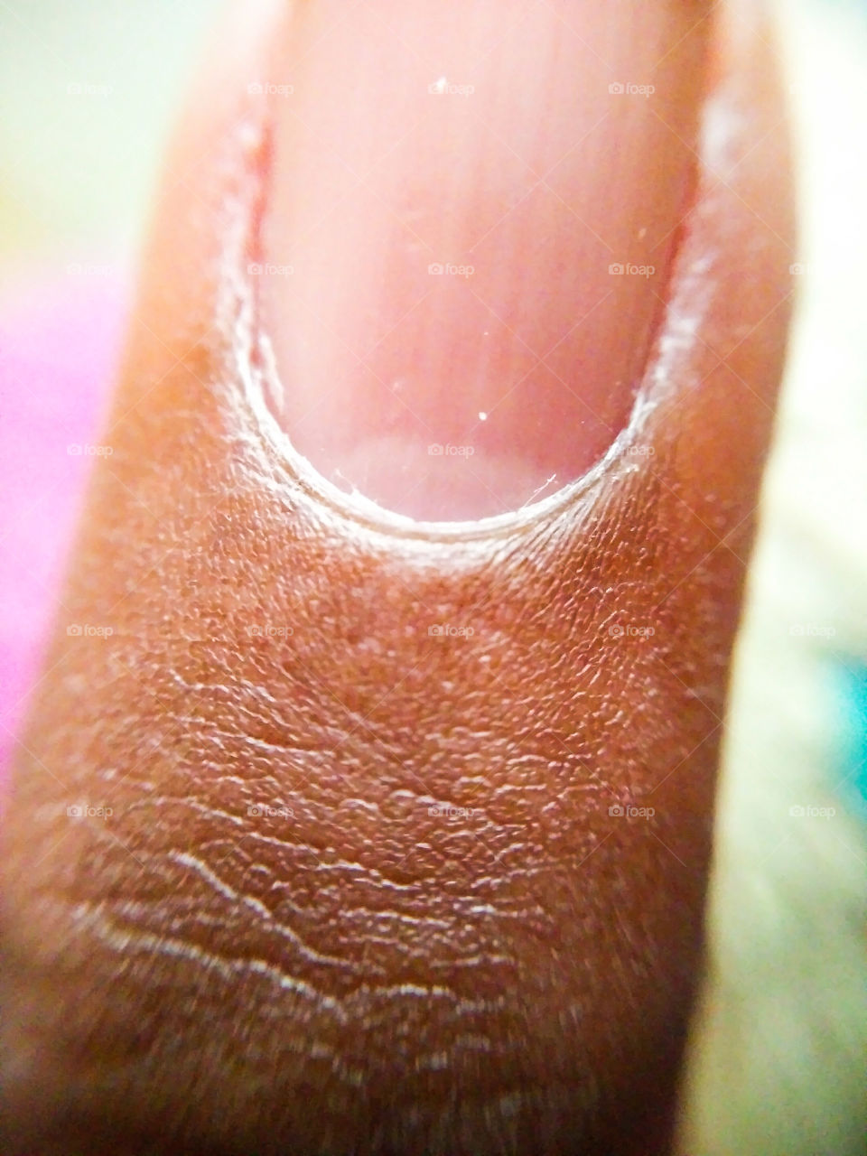 finger nail