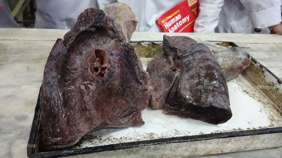 Anatomy class - lungs
