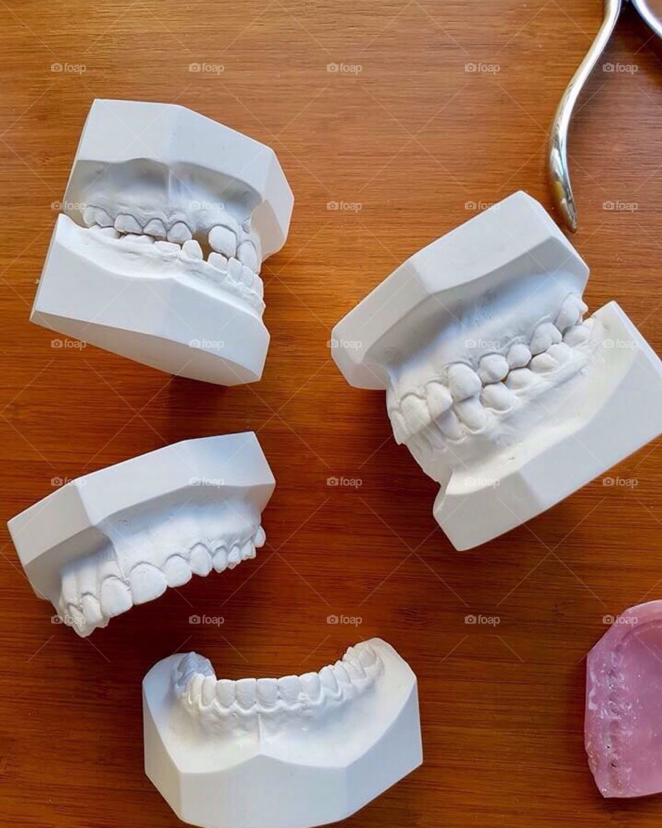 dental prosthesis molds 