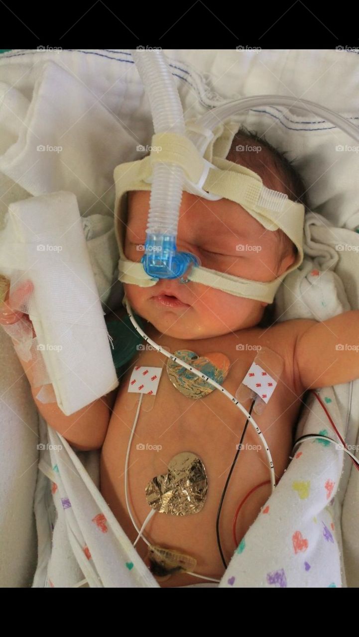 Baby boy on Cpap machine 