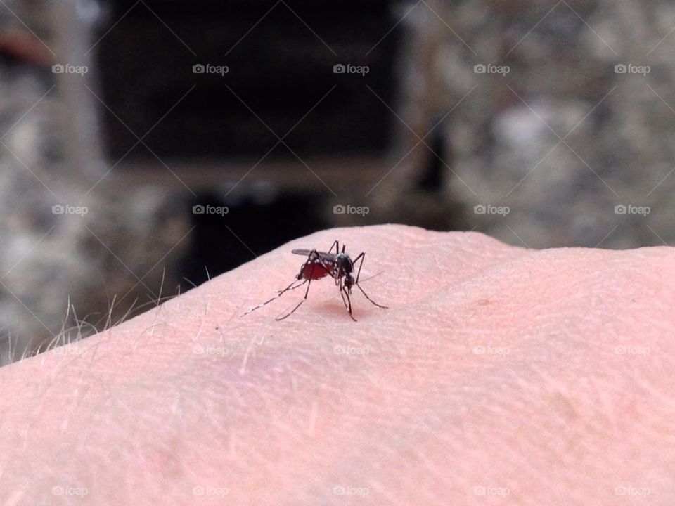 Mosquito bite!!! 