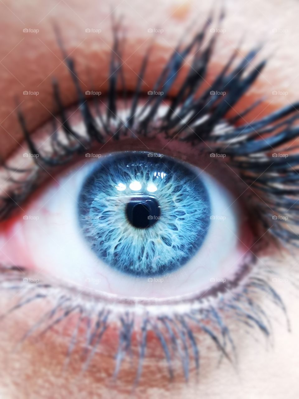 Close up of a blue eye. White web like pattern within the blue.