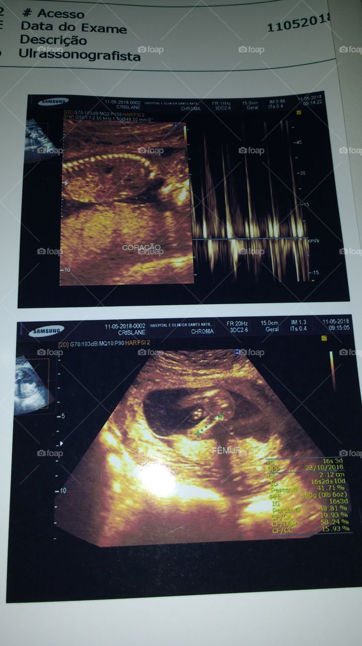 ultra-som do meu bebê