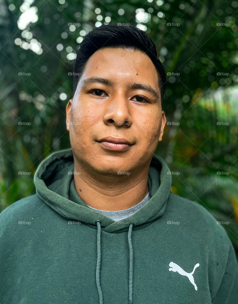dark-skinned man seen frontally, with pimples and pimple scars, with vegetation background