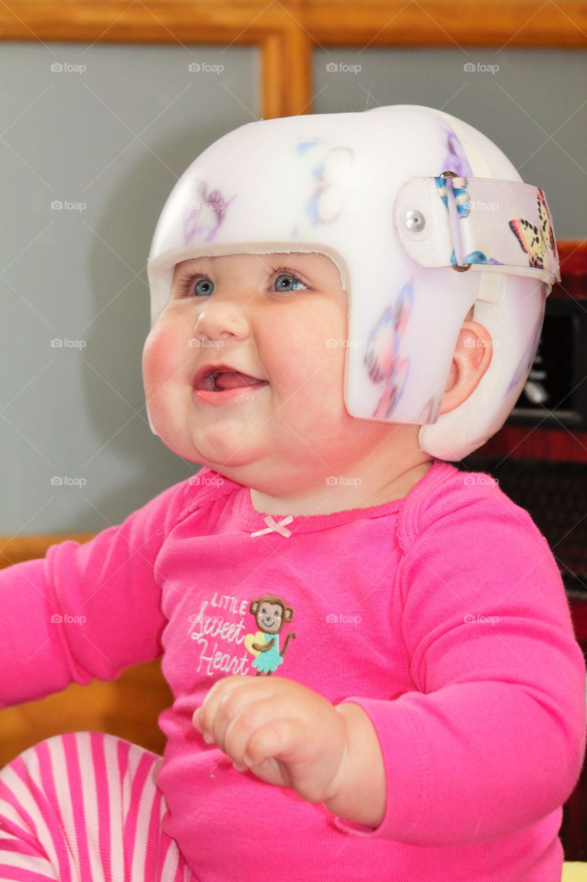 Plagiocephaly Cuteness!