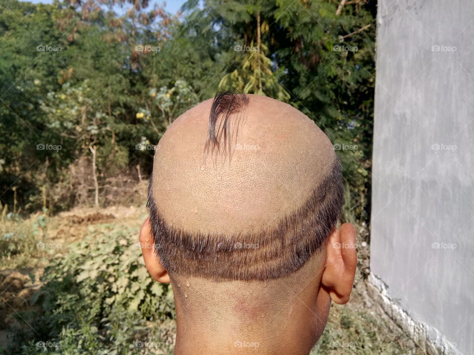 head without hair
