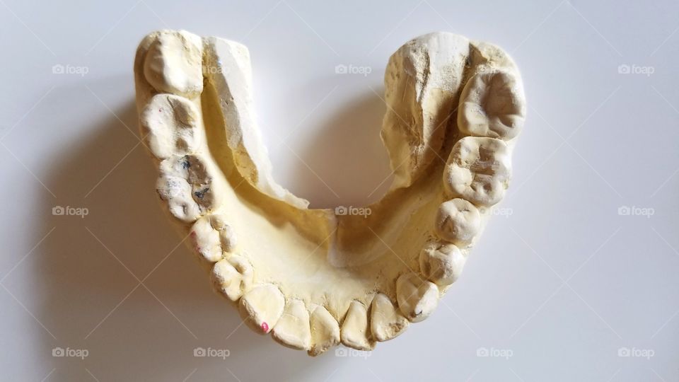 Dental impressions