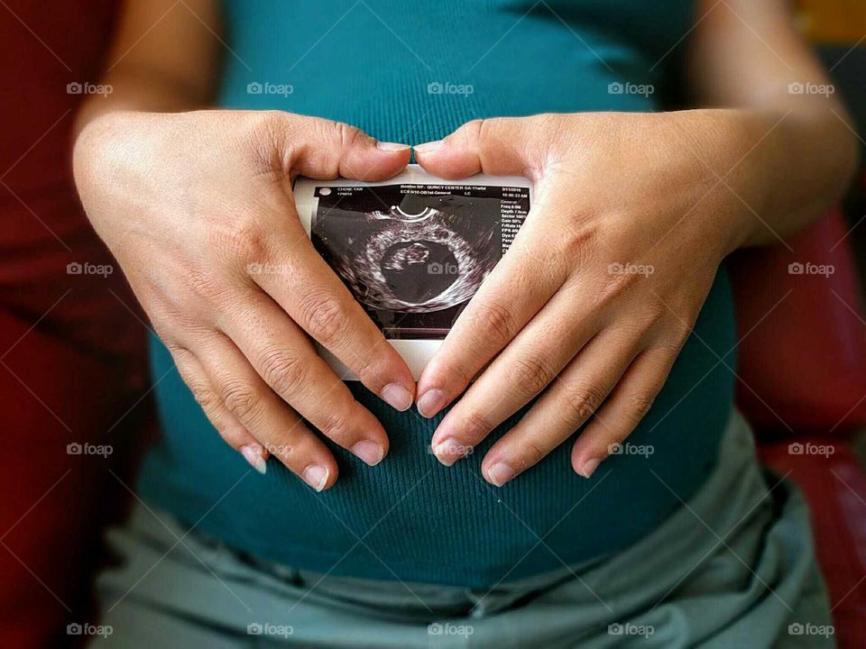 Mother embraces ultrasound photo